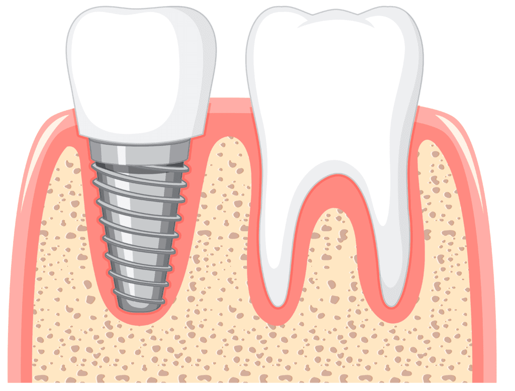 Best Dental Hospital in Nizampet