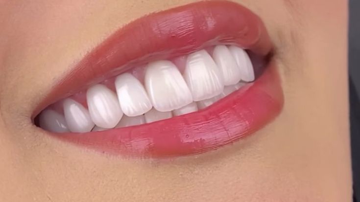 Choose Best Invisible Aligner