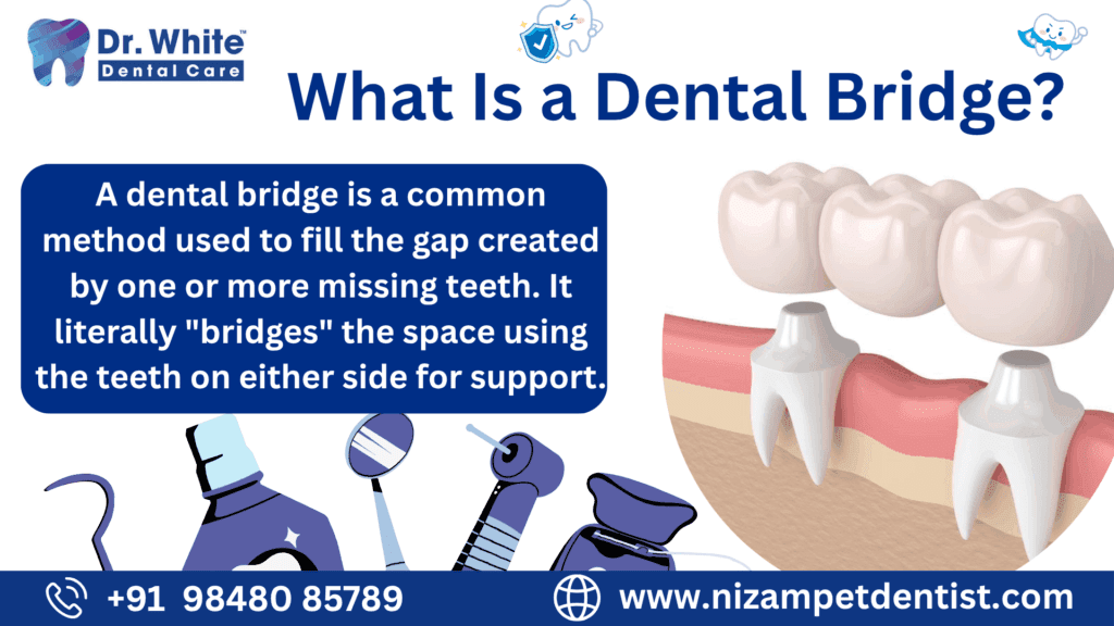 Dental Implant VS Dental Bridge
