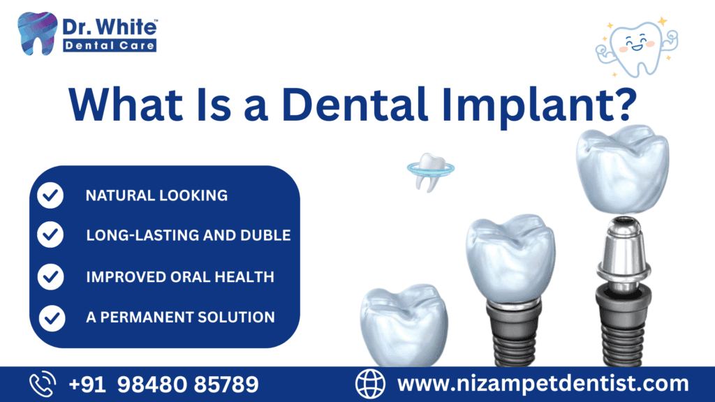 Dental Implant VS Dental Bridge