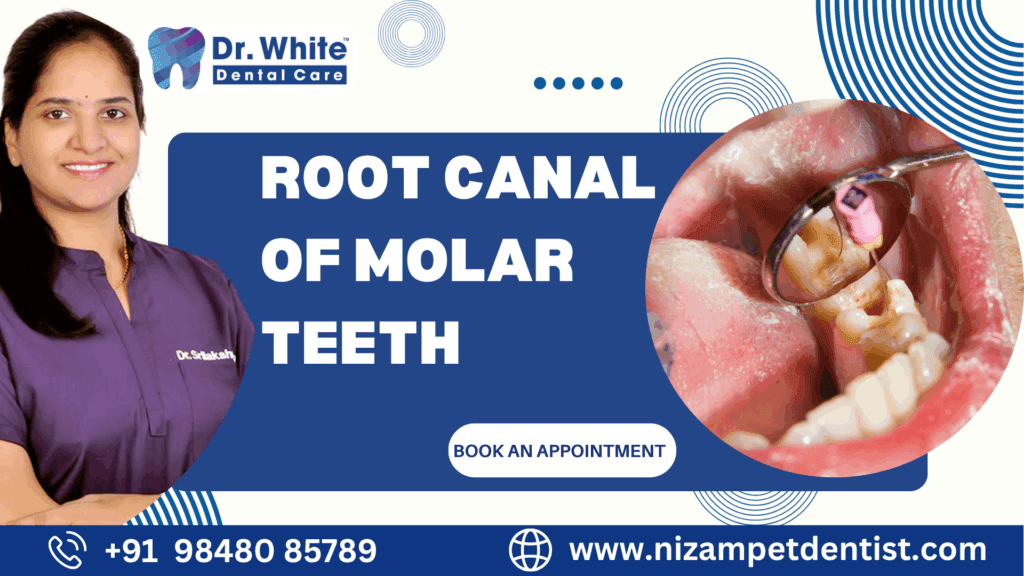 Root Canal of Molar Teeth