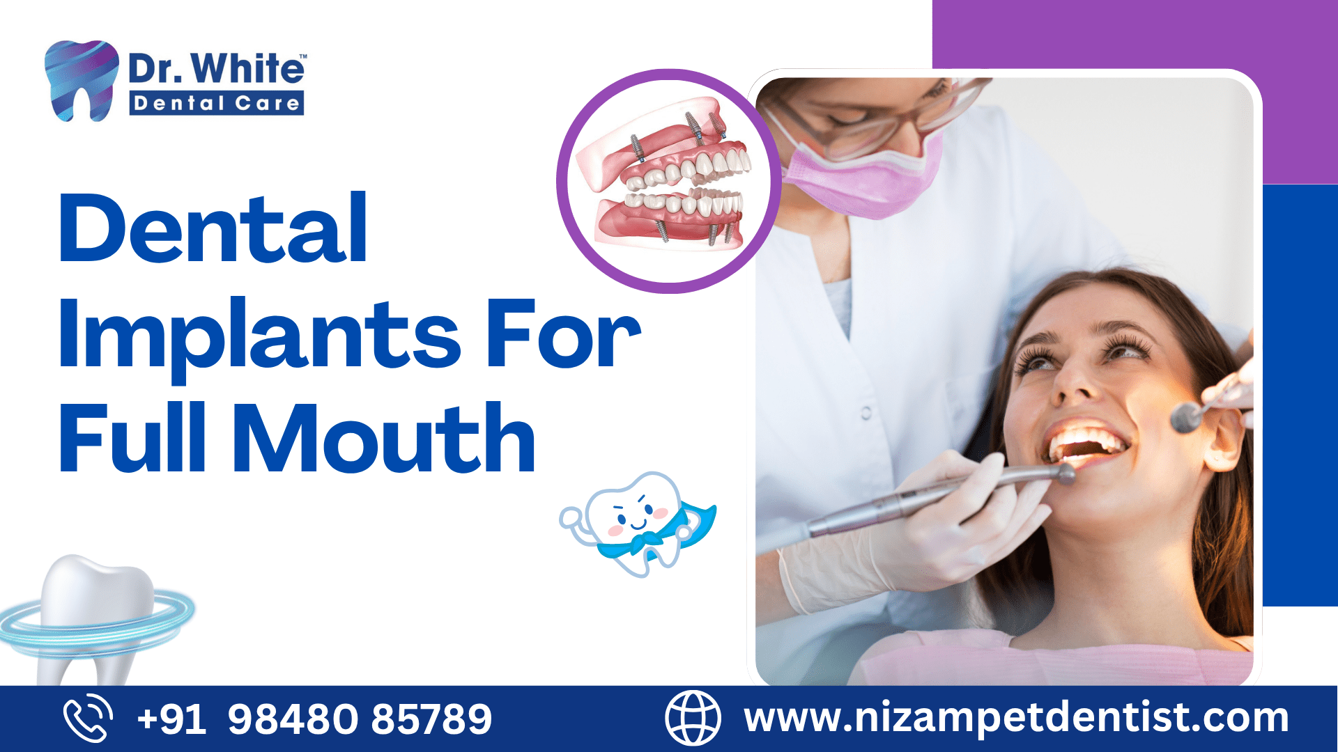 Dental Implants For Full Mouth