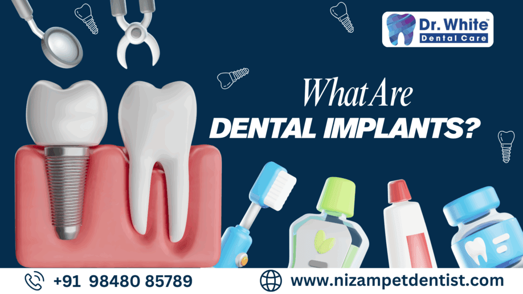 How Long Do Dental Implants Last?