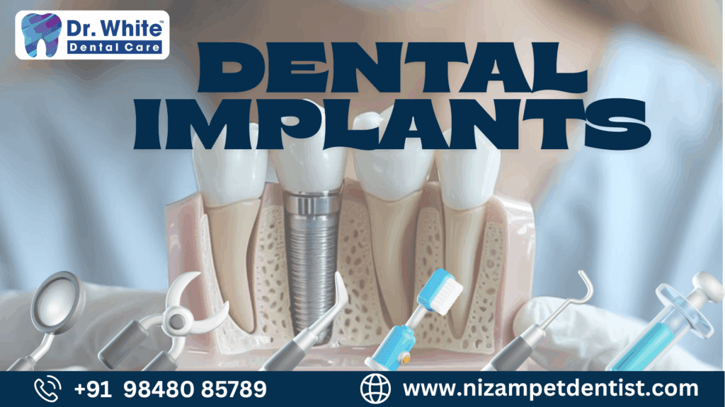 Dental Implants vs Bridges vs Dentures