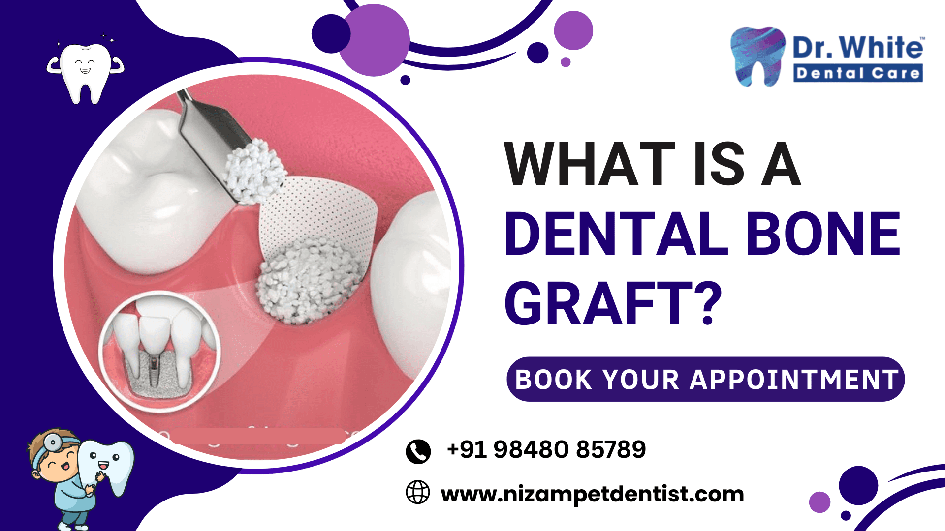 What is a Dental Bone Graft