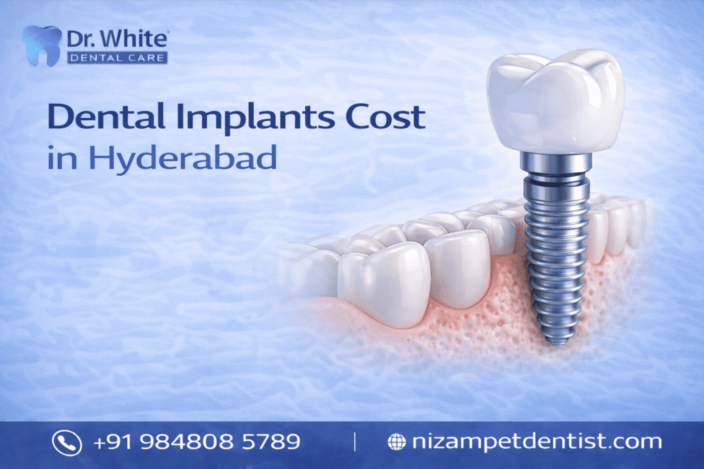 Dental implants cost in hyderabad