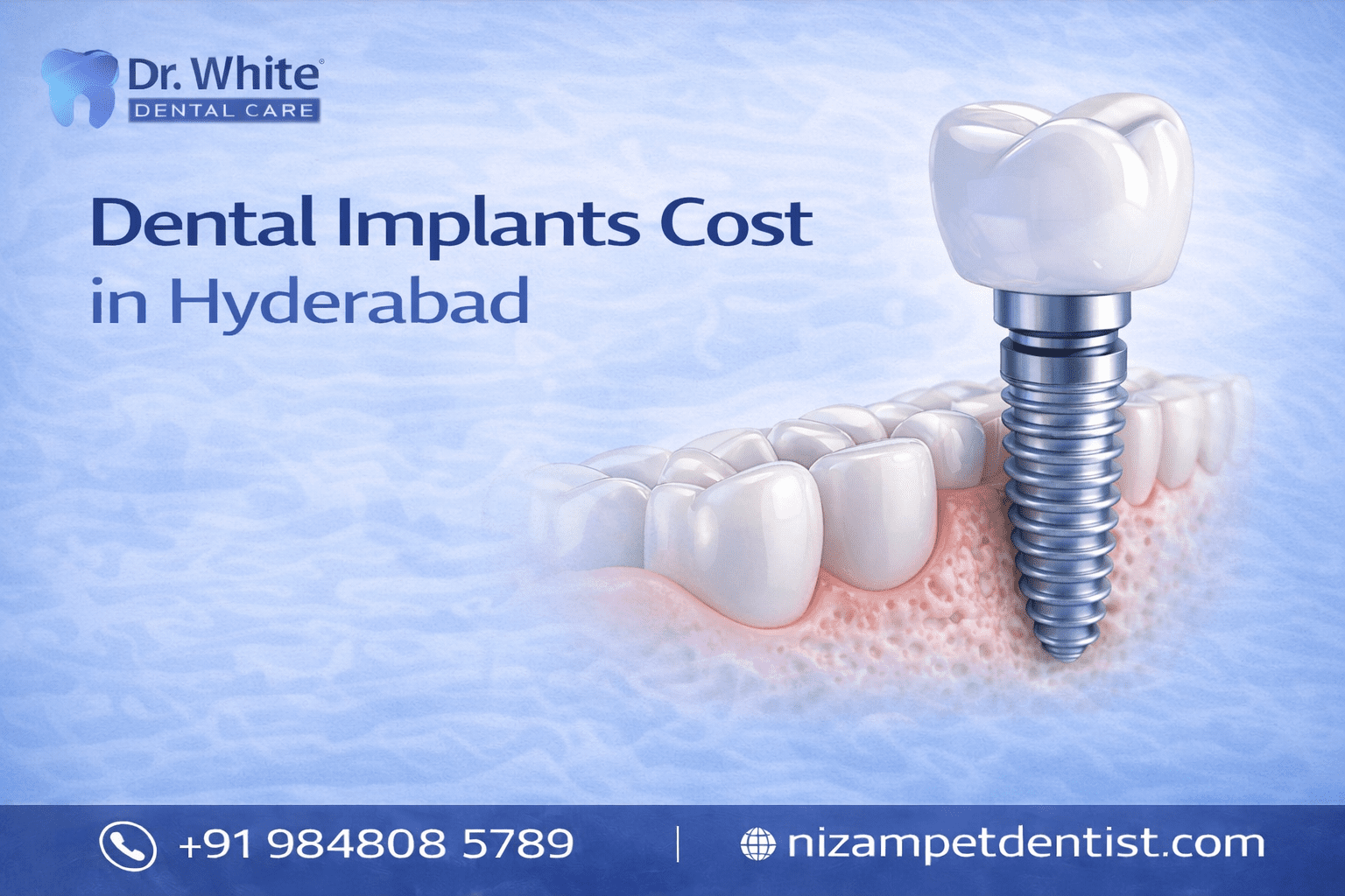 Dental implants cost in hyderabad