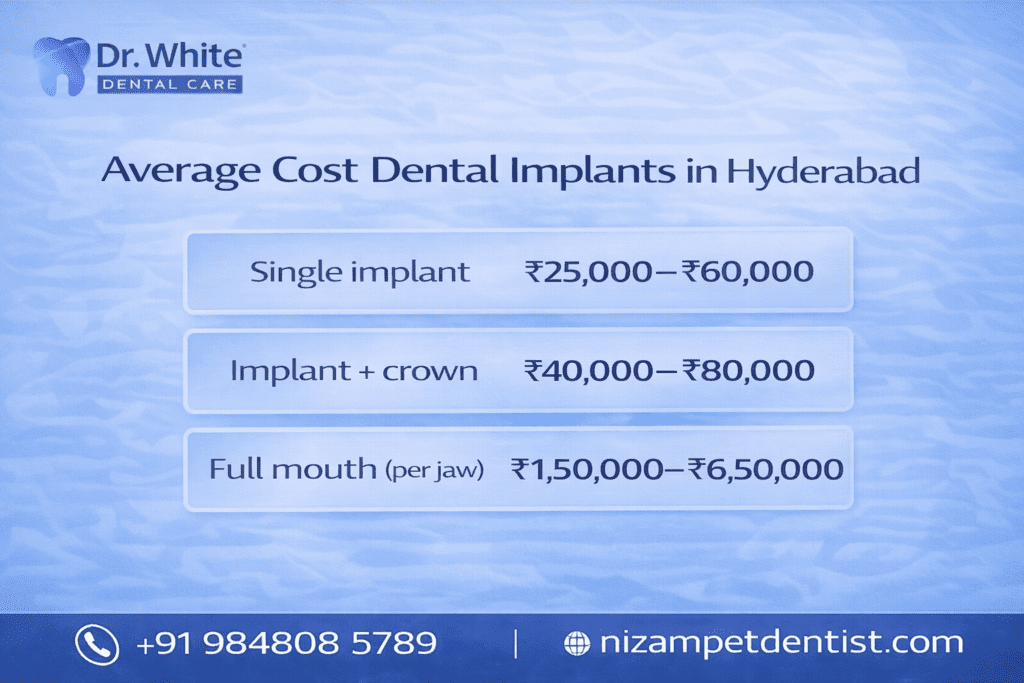 implants cost overiview