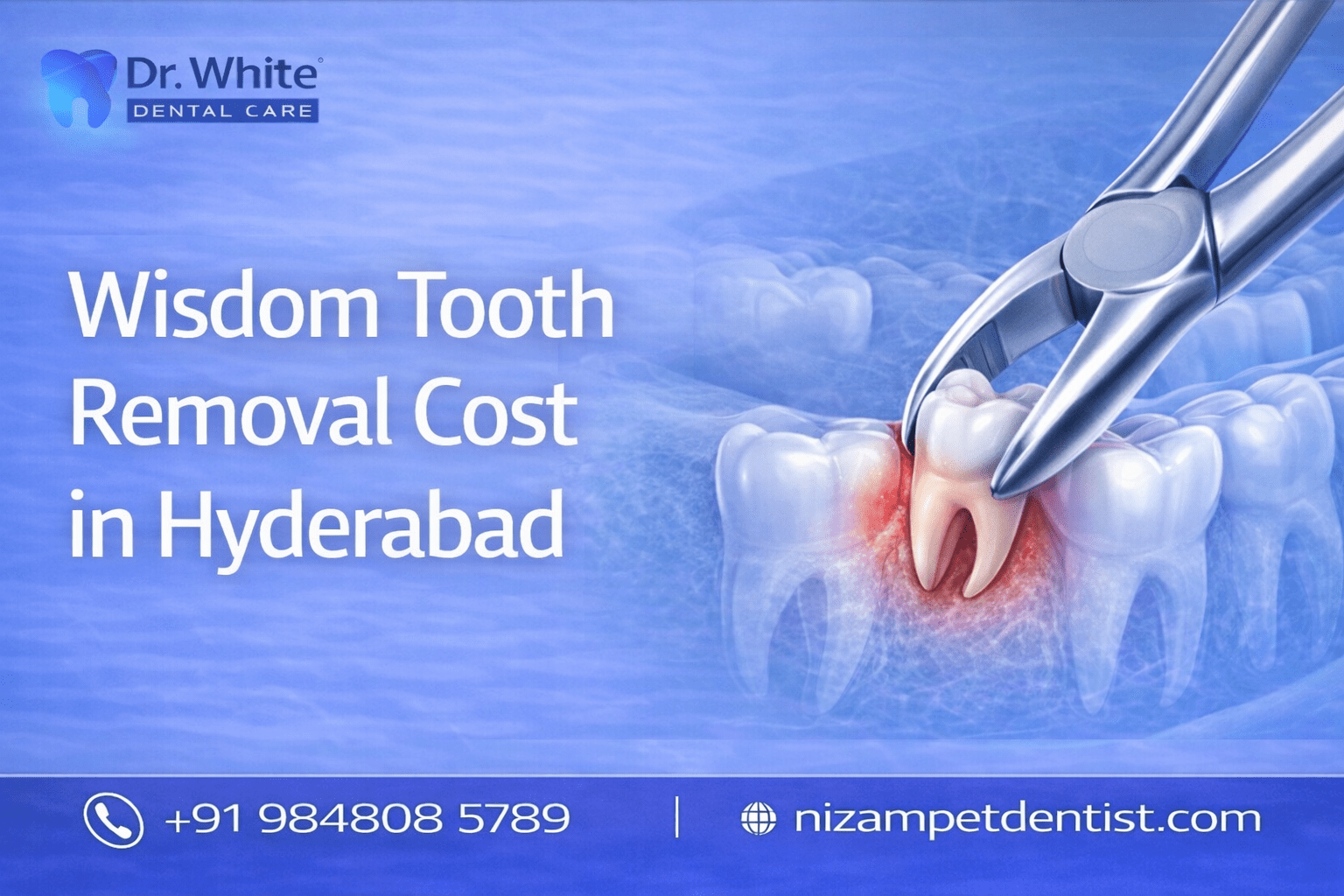 Wisdom Tooth removal cost in hyderabad