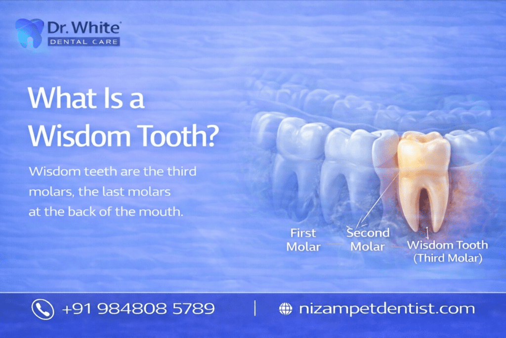 wisdom teeth removal cost in hyderabad