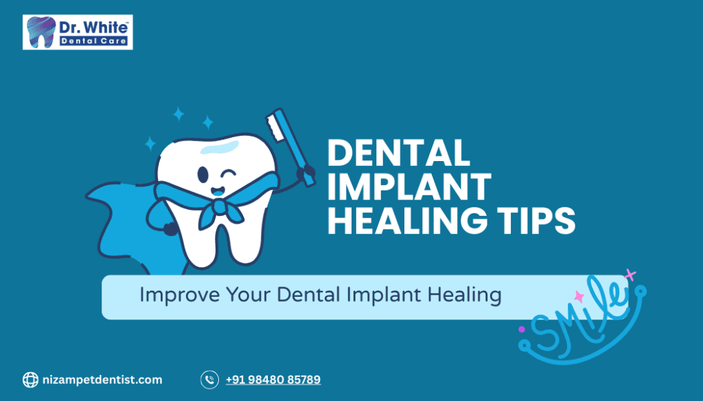 Complete Dental Implant Recovery Timeline & Healing Stages