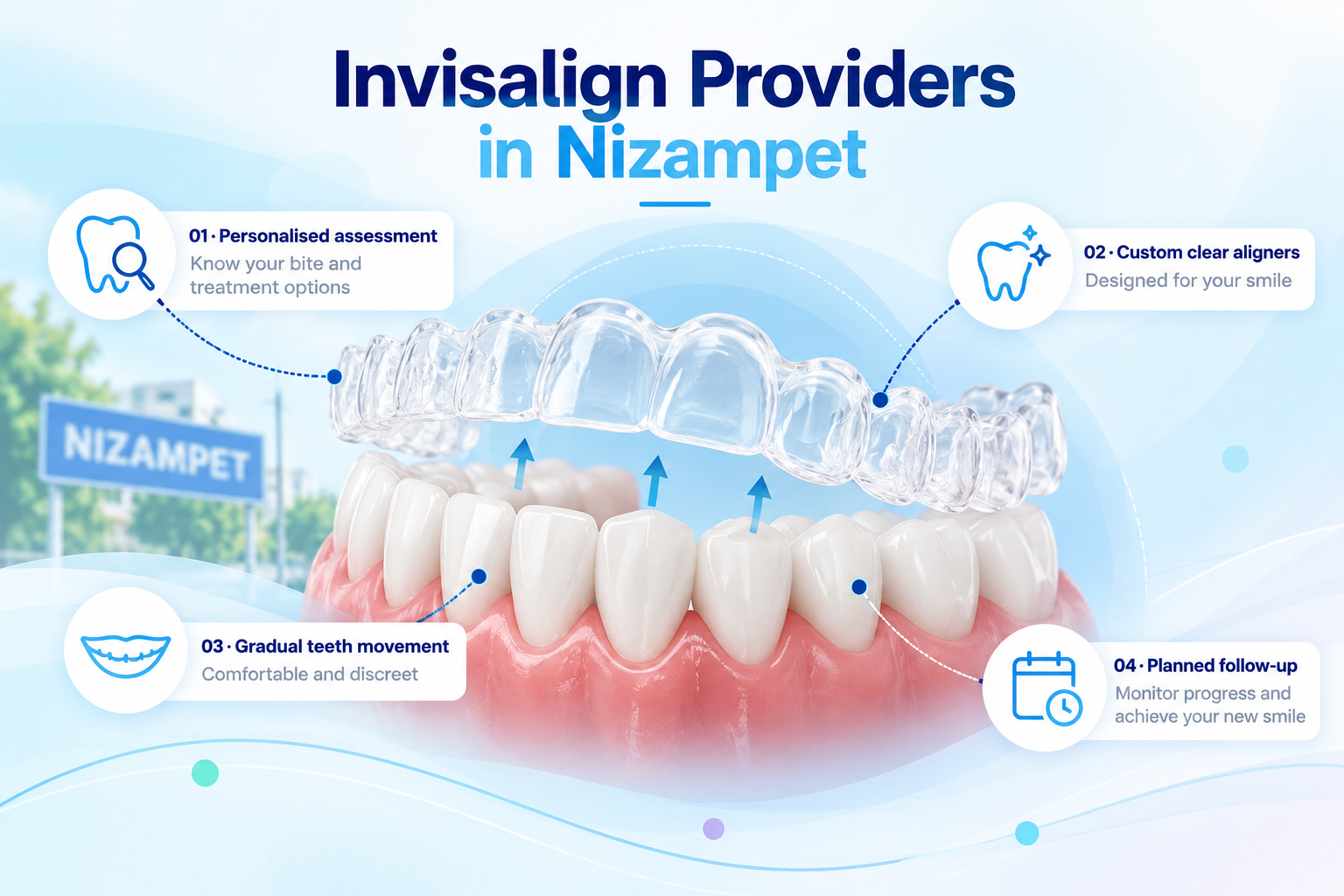 Invisalign providers in Nizampet illustration showing transparent clear aligners positioned above teeth with personalised orthodontic treatment steps