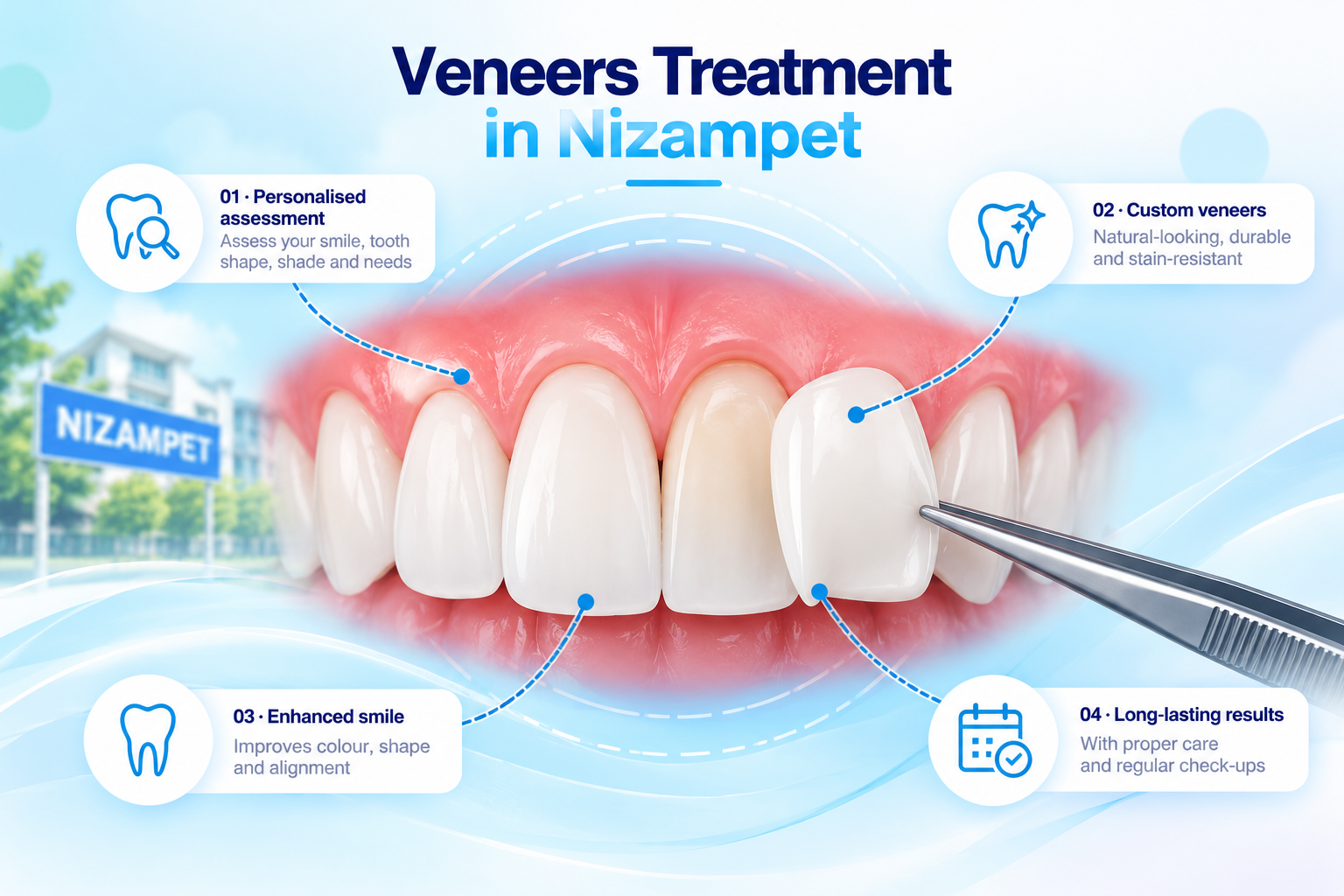 Veneers treatment in Nizampet illustration showing a custom dental veneer being placed over a front tooth to improve smile appearance