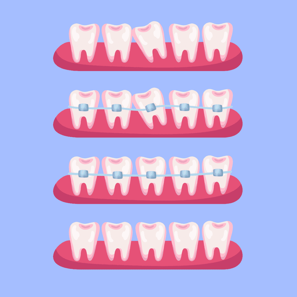 Best Dental Hospital in Nizampet