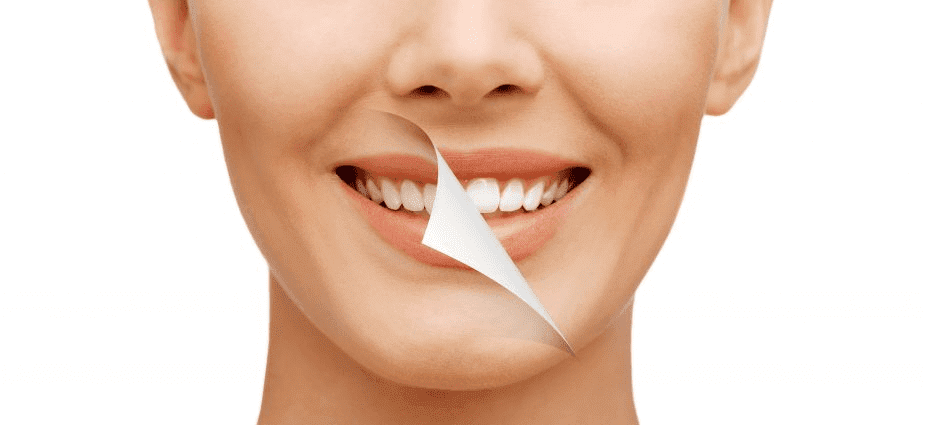 Best Smile Makeover Treatment in Nizampet
