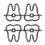 Braces-and-Aligner