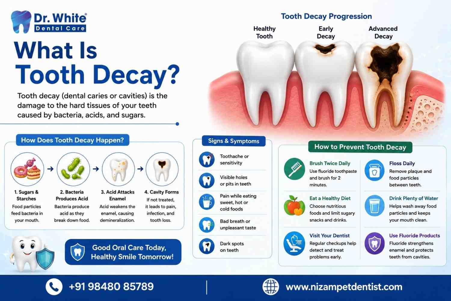 what is tooth decay