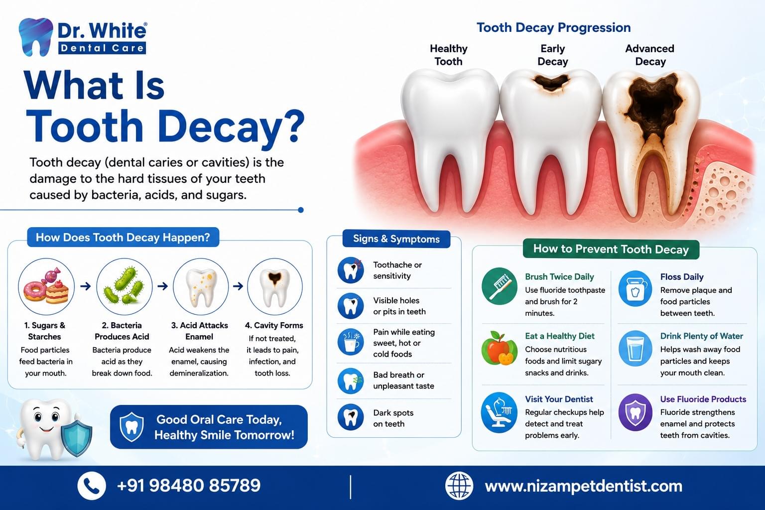 what is tooth decay