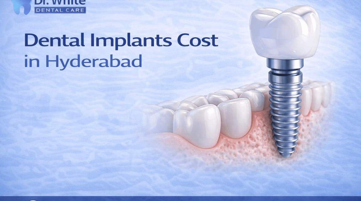 Dental implants cost in hyderabad