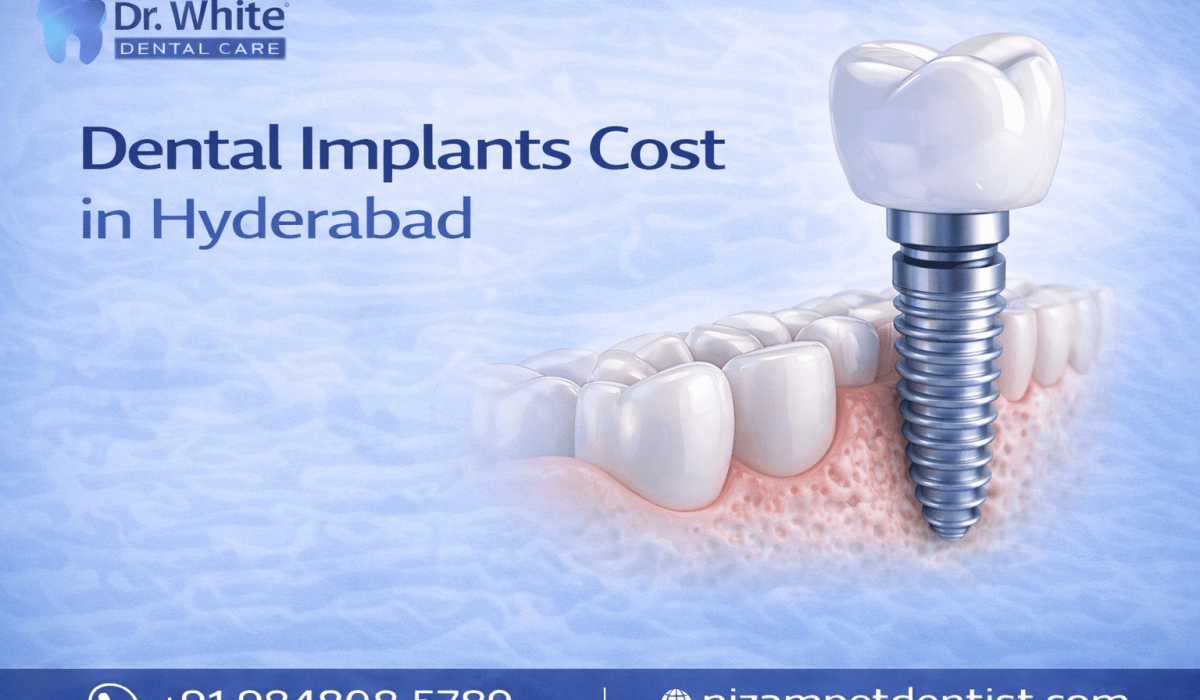 Dental implants cost in hyderabad